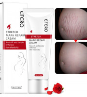 Efero Stretch Mark Repair Cream